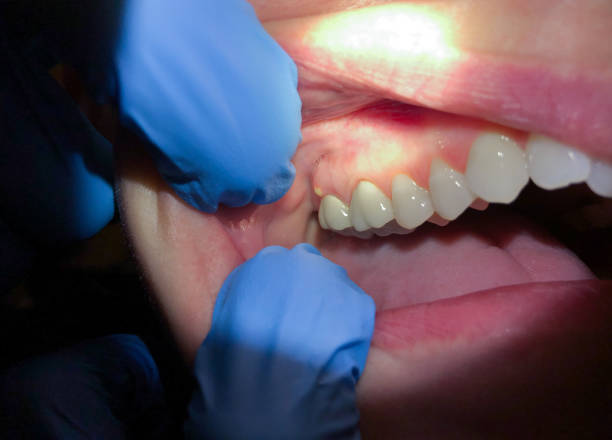 Best Walk-In Emergency Dentist in Royersford, PA