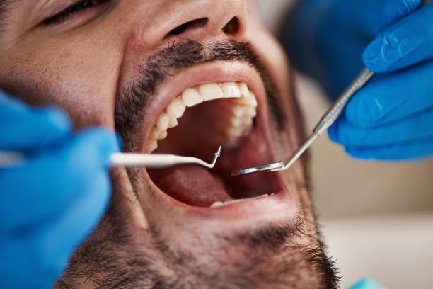 Best Emergency Broken Tooth Repair in Royersford, PA