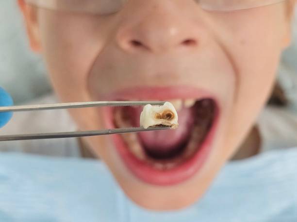 Best Emergency Treatment for Toothache in Royersford, PA